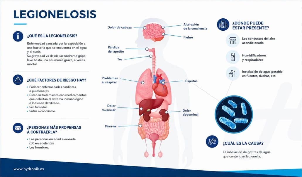 Infografía Legionelosis - causas y síntomas