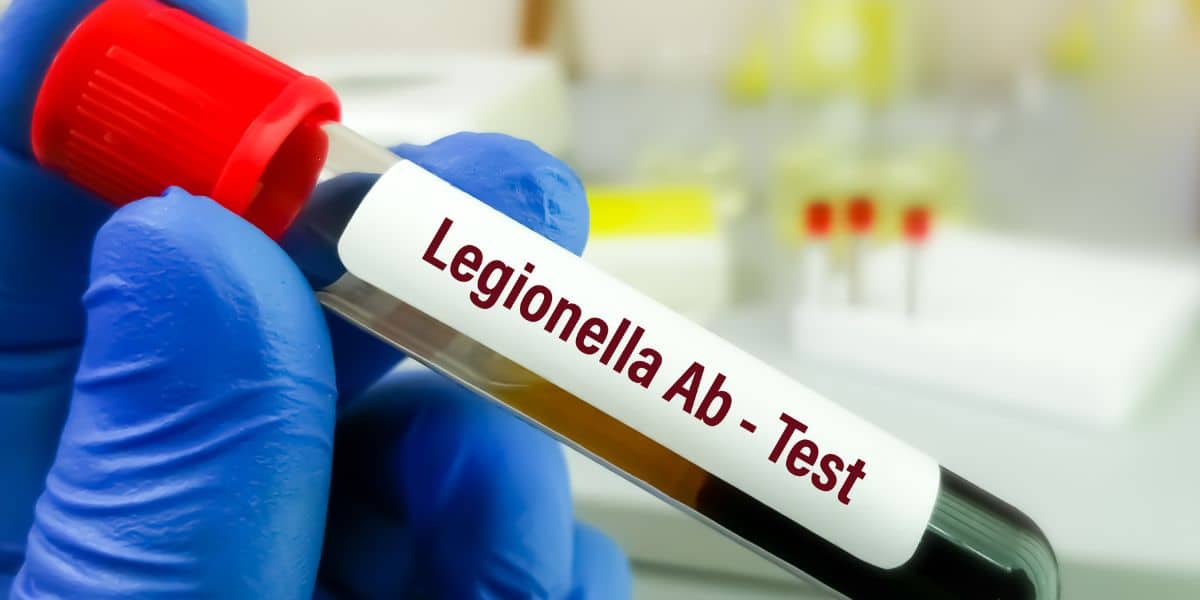 Imagen destacada Intercambiadores IHI_ La Solución Definitiva en el Control de Legionella